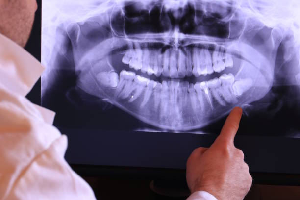 Best Emergency Treatment for Oral Infections in Shiner, TX